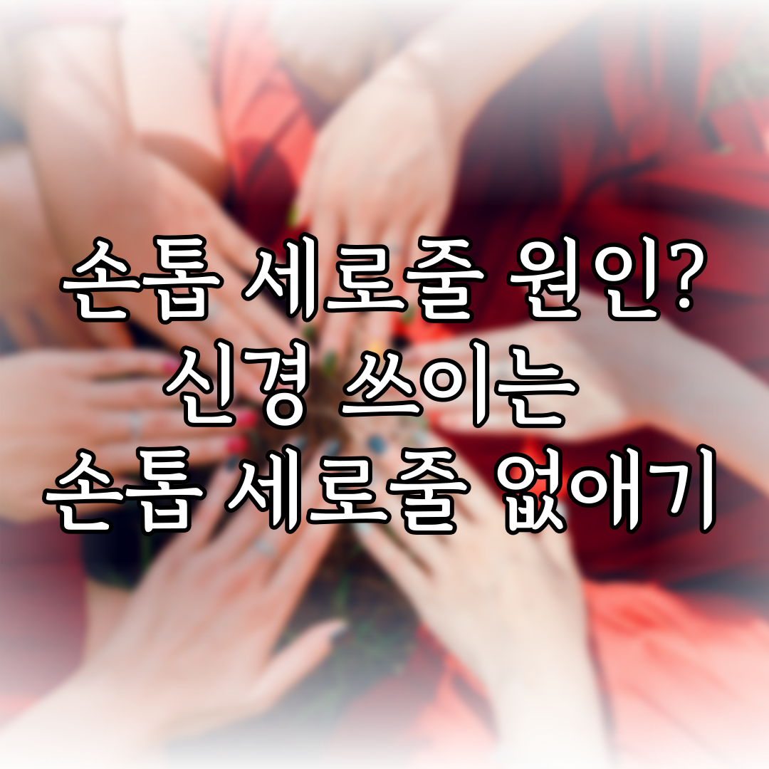 손톱 세로줄 원인? 신경 쓰이는 손톱 세로줄 없애기 특성 이미지